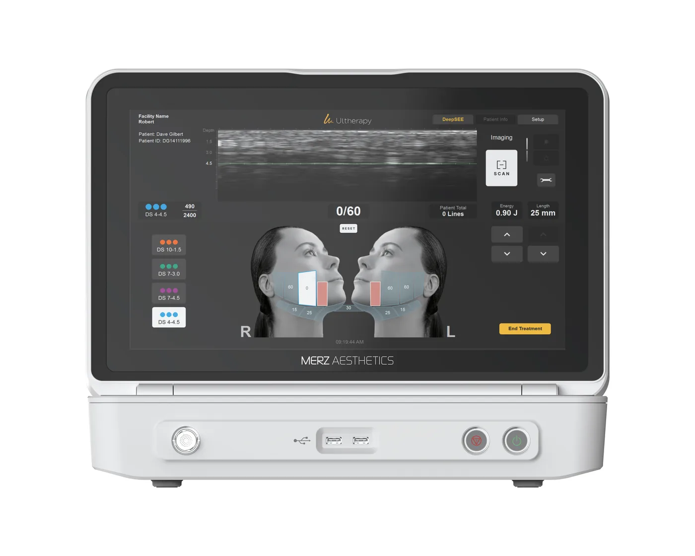 Ultherapy Prime console and display in the treatment room at Dear Clinic Cheongdam
