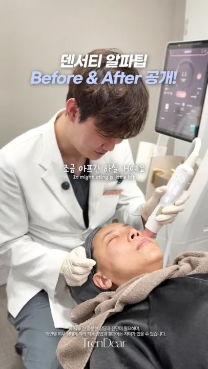 Doctor treating the lower face with the Density Alpha tip at Dear Clinic